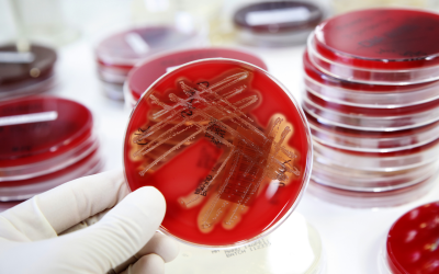 Antibiotic reduction: strong focus on biosecurity