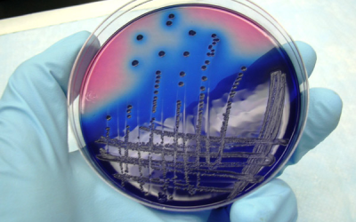 Weak spot of antibiotic-resistant bacteria found