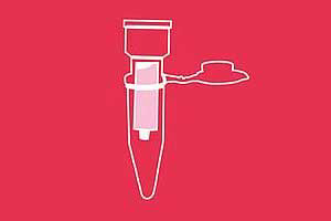 Product: Mycospin  clean-up prior to mycotoxin analysis