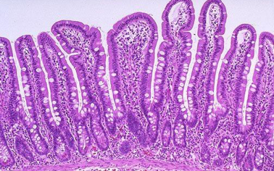 The intestine: an overlooked aspect of mycotoxin challenge