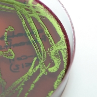 E. coli: the source of the ‘next biofuel’