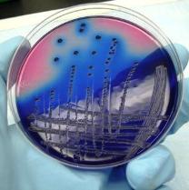 $1 million to study DDGS and E.coli link